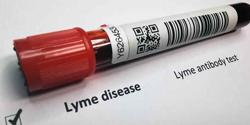 Understanding the Long-Term Complications of Lyme Disease